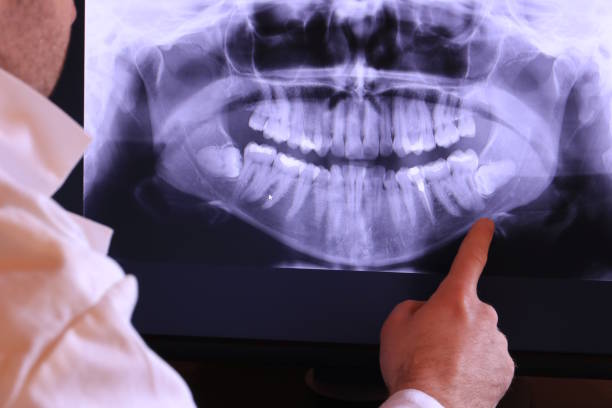 Best Emergency Dental Care for Broken or Chipped Teeth in Coleman, MI