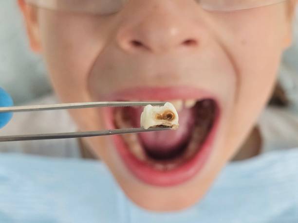 Best Cosmetic Emergency Dentistry in Coleman, MI