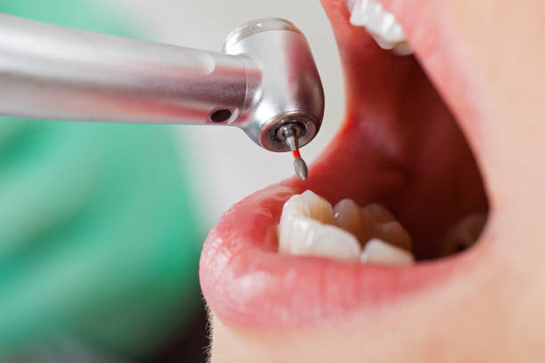 Best Emergency Treatment for Dental Infections or Abscesses in Coleman, MI